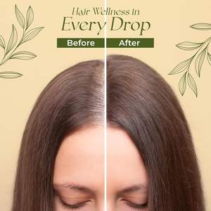 <span class=keywords><strong>Huile</strong></span> de croissance capillaire naturelle OEM R'ENDASE infusée avec 10 huiles végétales premium et de l'<span class=keywords><strong>huile</strong></span> de romarin biologique pour un volume et une nutrition accrus 60ml - Product Image 6