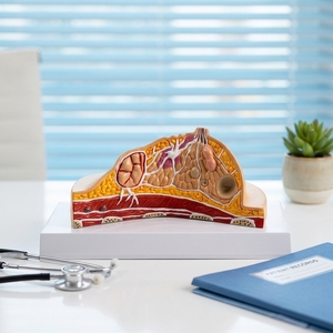 Modelo de Anatomía de Sección Transversal de Seno con Características Patológicas, Estructura de la Glándula Mamaria para la Enseñanza de Biología - Product Image 5