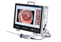 Système de caméra d'endoscopie médicale intégrée Full HD IKEDA avec moniteur 22 pouces et imagerie chirurgicale