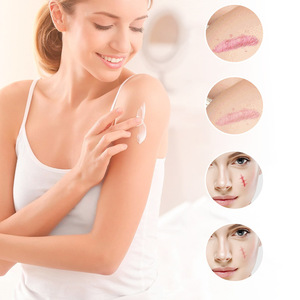 Crema para Cicatrices Corporales con Ingredientes Naturales de Aloe Vera para Nutrir la Piel y Reducir las Estrías - Product Image 4