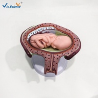 Modelo de Crecimiento Fetal Multietapa con Útero y Placenta, Ayuda de Entrenamiento Médico en Embriología para Escuelas de Obstetricia, CE/ISO/ROHS/CNAS