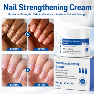 Crème fortifiante <span class=keywords><strong>pour</strong></span> les <span class=keywords><strong>ongles</strong></span>, dure comme un sabot, ingrédients naturels, traitement contre les mycoses des <span class=keywords><strong>ongles</strong></span> des orteils, <span class=keywords><strong>meilleur</strong></span> traitement - Product Image 1
