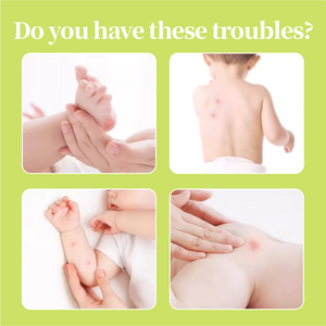 Crème Répulsive <span class=keywords><strong>Anti</strong></span>-<span class=keywords><strong>Moustiques</strong></span> Apaisante et Rafraîchissante au Menthol, Huile de Camélia, Vitamine E et Cire d'Abeille – Stick Apaisant Contre les Piqûres de <span class=keywords><strong>Moustiques</strong></span> - Product Image 2