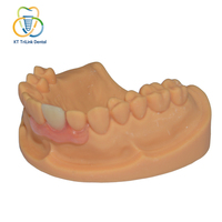 Prothèse dentaire partielle amovible en nylon thermoplastique flexible de haute qualité, prothèse dentaire personnalisée