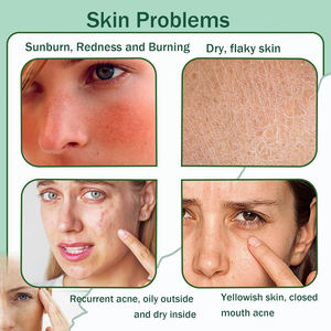 Loción Hidratante de Rápida Absorción y Larga Duración, Refrescante, para el Cuidado de la Piel, Gel de Aloe Vera para Después del Sol, para Rostro y Cuerpo - Product Image 3