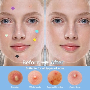 Cerotti Anti-Acne a Forma di Stella Colorati con Aloe Vera, Olio di Tea Tree, Acido Salicilico, Idrocolloide, Organici, Vegani, Restringenti i Pori, 40 Pezzi per la Cura della <span class=keywords><strong>Pelle</strong></span> - Product Image 5