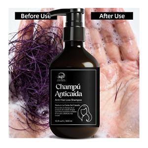 Champú <span class=keywords><strong>Anticaída</strong></span> Intenso al por Mayor de Fábrica con Extractos Herbales, Champú <span class=keywords><strong>Anticaída</strong></span> con Proteína de Trigo y Hierbas Asiáticas - Product Image 3