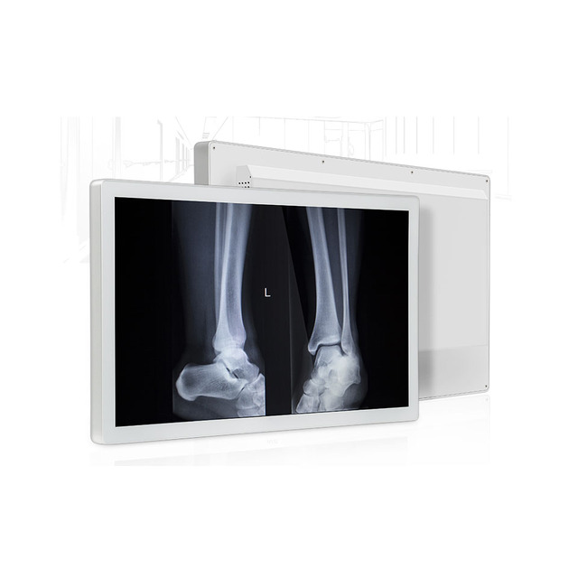 24 / 27 / 32 " Inch 1000nits HD Medical Display 8M Diagnostic EMC Medical Radiation Greyscale High Brightness 4K Monitor