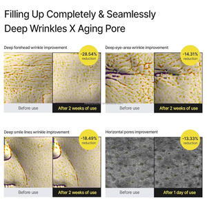 レチノール注射血清は、細かい線としわを深く水分補給し、肌を明るくします - Product Image 4