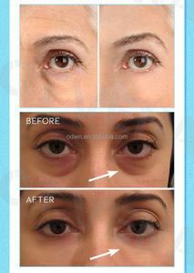 OTVENA niedriges MOQ magisches Lifting-Augenbeutel Dunklere Kreise Geschwüre Augenpflegeprodukt - Product Image 2