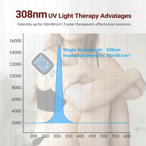Appareil de luminothérapie UVB 308 nm pour usage domestique, traitement de l'eczéma, du vitiligo, du <span class=keywords><strong>psoriasis</strong></span>, avec des résultats rapides, thérapie cutanée ciblée - Product Image 3
