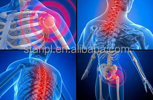 <span class=keywords><strong>Precio</strong></span> <span class=keywords><strong>de</strong></span> fábrica Beijing Starlight Red Blood Spider Vein Removal 980Nm Diodo Láser Máquina <span class=keywords><strong>de</strong></span> <span class=keywords><strong>eliminación</strong></span> vascular Alivio del dolor - Product Image 2