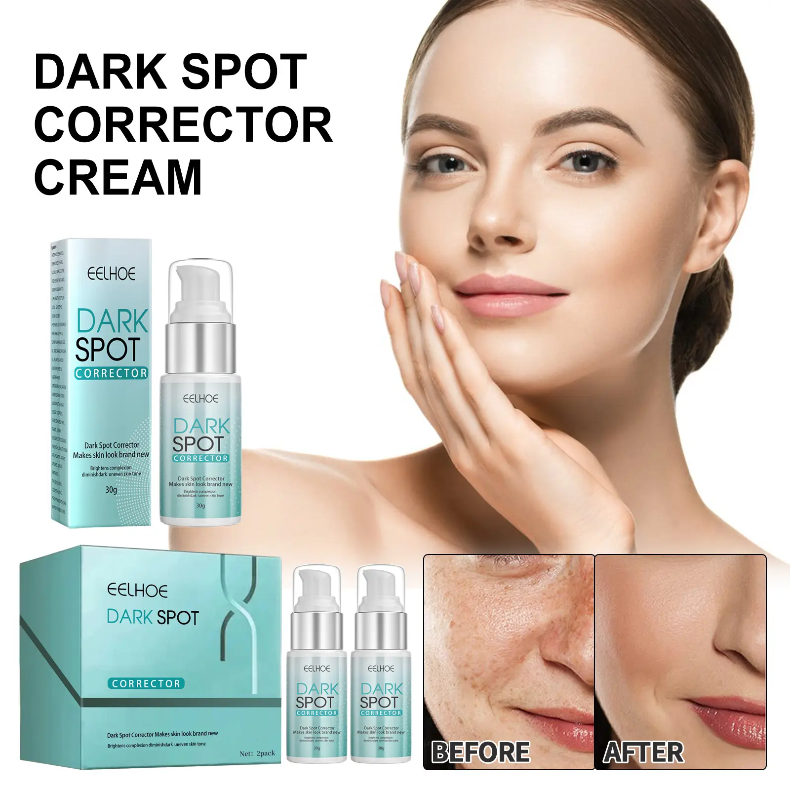 Heißer Verkauf Dark Spot Corrector Remover für Gesicht und Körper, formuliert mit Advanced Ingredient Niacin amide Flecken entfernungs creme