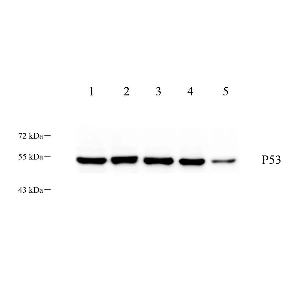 נוגדן ATF-4 ארנב polyclonal נוגדנים GB111157 (עכבר, עכברוש מח, מוח, cortex) 1: 500-1: 1000