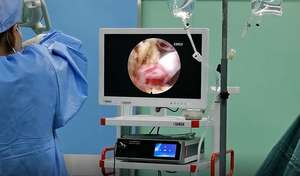 Medische Hd 1080P 1000 Lijnen Toren Artroscopie Endoscopie <span class=keywords><strong>Camera</strong></span> Systeem Met Scheerapparaat - Product Image 5