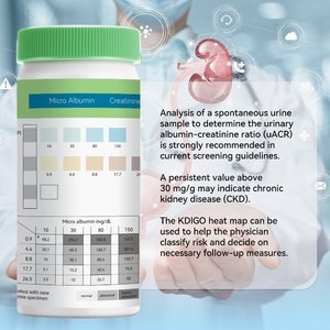 URS-2MAC Urine <strong>test</strong> <strong>Strips</strong> Detecting Creatinine and Micro <strong>Albumin</strong>