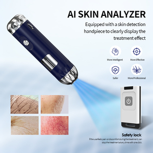 Nuevo Producto 2026, Máquina Profesional de Depilación Láser IPL OPT, Dispositivo de Rejuvenecimiento de la Piel y Eliminación de Pigmentos - Product Image 2