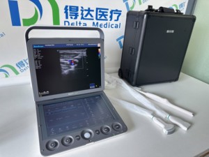 Ecógrafo Portátil Sonoscape S9 Tipo Laptop con Doppler Color para Diagnóstico Abdominal, Cardíaco, Obstétrico/Ginecológico - Product Image 1