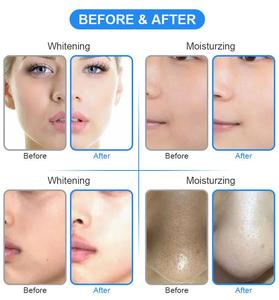 Desktop Hydro Dermabrasion Machine with Oxygen Spray for Professional Facial Cleansing and Skin Rejuvenation Beauty Spa - Product Image 6