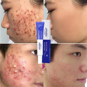 Crème réparatrice contre l'acné Anti-acné <span class=keywords><strong>hydratante</strong></span> <span class=keywords><strong>cicatrice</strong></span> points noirs rétrécissement Pores blanchissant soins de la peau du visage crème contre l'acné - Product Image 4