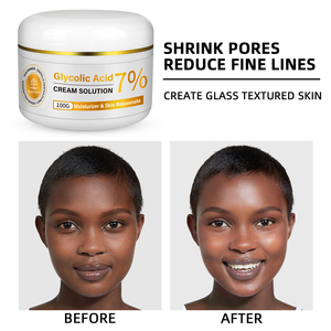 Cuidado DE LA PIEL Iluminador 7% Ácido glicólico <span class=keywords><strong>Crema</strong></span> facial <span class=keywords><strong>Hidratante</strong></span> <span class=keywords><strong>Crema</strong></span> iluminadora de la piel que reduce los poros - Product Image 3