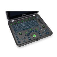 Scanner à ultrasons portable médical Système de diagnostic par ultrasons pour ordinateur portable Machine à ultrasons médicale pour mammographie