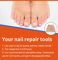des ongles des orteils Autocollants de correction des ongles antifongique Patch de réparation des ongles de marque privée