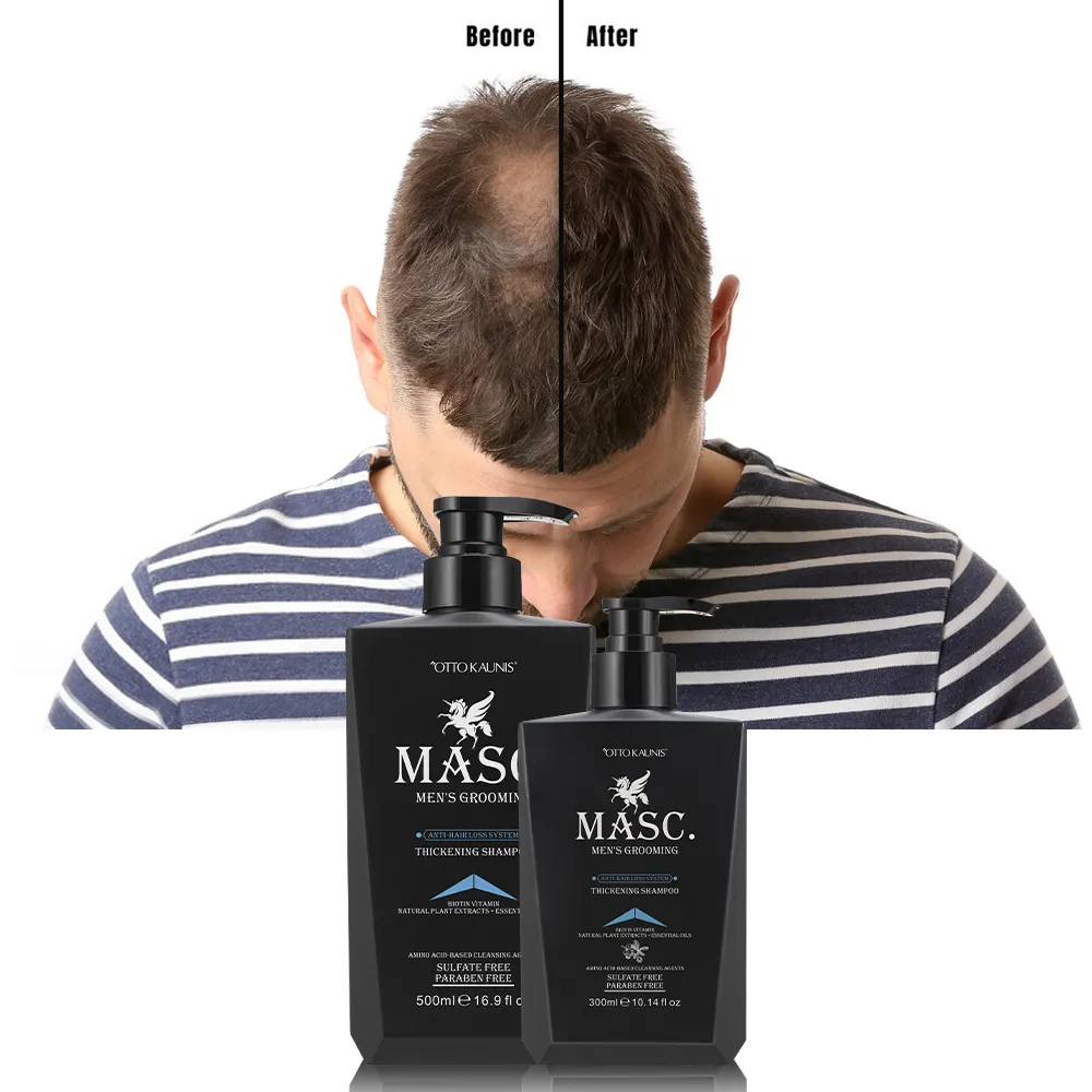 Биотин витамин аргановое масло против выпадения волос лечение без сульфата утолщенный шампунь