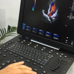 Échographe portable à bon prix, échographe couleur Doppler EO-P8 - Product Image 2