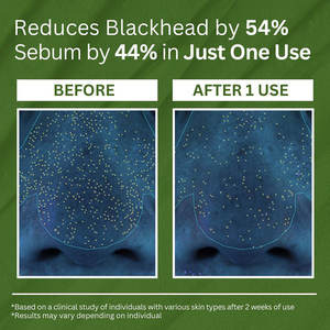 Mascarilla facial profunda con burbujas de albahaca <span class=keywords><strong>sagrada</strong></span> de etiqueta privada OEM para limpiar los poros, espinillas, paquete de lavado de burbujas, productos para el cuidado de la piel - Product Image 5