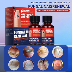New Arrival 7 Days Nail Fungus <strong>Treatment</strong> Serum Treast Fungus Bacteria Repair Damage Nail Grey Nail Care Essence Oil <strong>Treatment</strong> - Product Image 4