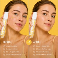 Gel anti-acné HALORINNA 50 ml, régulateur de sébum, apaisant, améliore la texture de la peau, pour tous types de peau, soin du visage relaxant, OEM