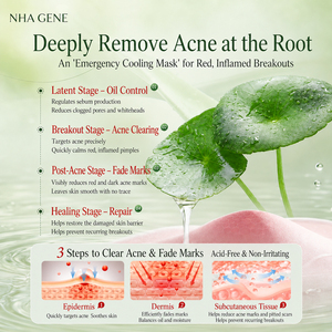Masque Facial à l'Acide Azélaïque le Plus Vendu, Traitement Anti-inflammatoire à l'<span class=keywords><strong>Arbre</strong></span> à Thé et à la Centella pour la Récupération de l'Acné, Formule de Soin en Gros - Product Image 3