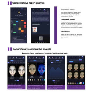 3D AI Pele Facial <span class=keywords><strong>Analyzer</strong></span> 3 Câmeras Profissionais Inteligente Máquina Diagnóstica Da Pele Rosto com <span class=keywords><strong>Mini</strong></span> Detecção De Umidade - Product Image 6