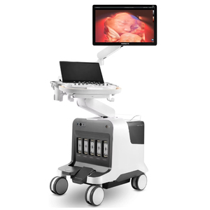 Sonoscape P80 Sistema de Ultrasonido Doppler Color de Alta Calidad y Sistema de Ultrasonido con Carro para Uso Veterinario - Product Image 1