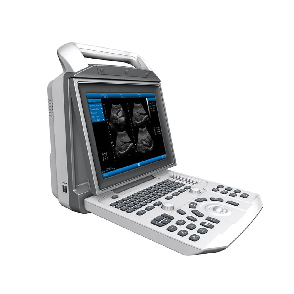 Portable Medical Color Doppler Ultrasound Zoncare i50 System 3d 4d Color Doppler Laptop Ultrasound