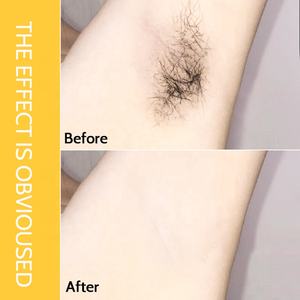 Spray dépilatoire permanent sans douleur en marque propre, mousse pour les aisselles, les parties intimes, les jambes, le corps, spray pour éliminer les <span class=keywords><strong>poils</strong></span> - Product Image 4