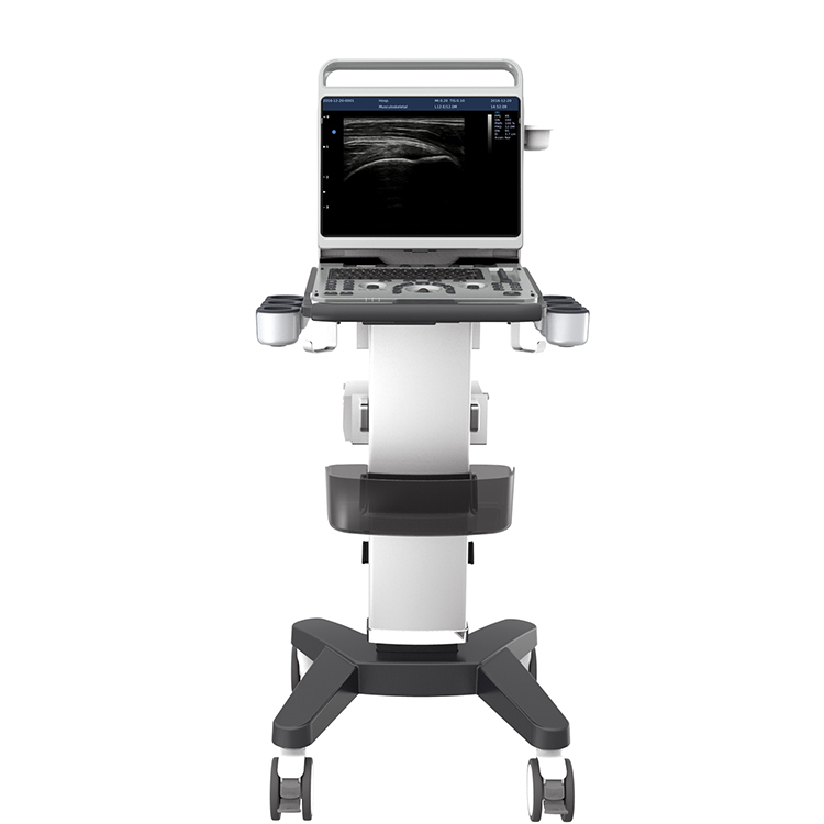 Fábrica Chison Ebit 50 Equipos De Ultrasonido Médico 3D 4D Sistema de Doppler de Color Con Sonda Convexa