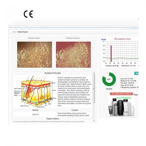 Analizador de Piel Digital Inteligente de Alta Definición con Triple Escaneo, Análisis de Pigmentación para Uso Doméstico, Instrumento de Belleza, 1 Año de Garantía - Product Image 6