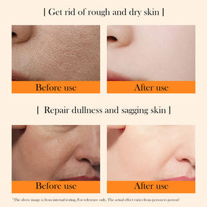 Crema Viso Biologica Bestseller con Vitamina C, Sbiancante e Idratante, Rimuove le Macchie Scure, Crema Nutriente per il Viso - Product Image 2