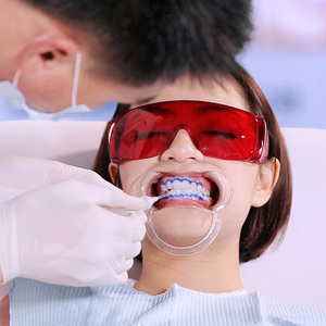 Gel barrière gingivale 1,2 ml – Protection des gencives pour blanchiment dentaire – Résine photopolymérisable pour protection des gencives lors du blanchiment des dents - Product Image 5