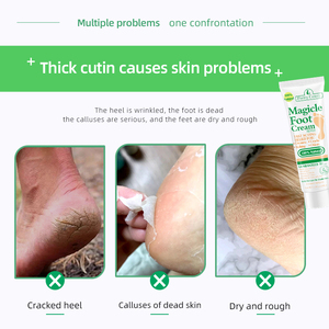 Peeling Fußpflege Ries Tool zur Entfernung abgestorbener Haut Entfernen von Fuß peeling Feuchtigkeit spendende Fußpflege creme für rissige Fersen - Product Image 6