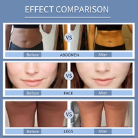 Nouvelle machine Velashape professionnelle, appareil de remodelage corporel par aspiration et rouleaux, élimination de la cellulite, pour salon de beauté, OEM ODM