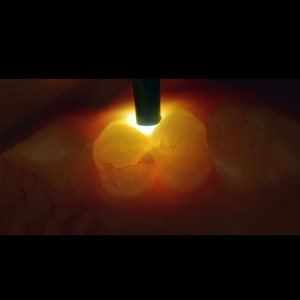 ไฟฉายอัจฉริยะ YY รุ่นส่งออก ไฟส่องฟัน แสงขาวเย็น 5500-7000K ใช้พลังงานไฟฟ้า ได้รับการรับรองมาตรฐาน CE - Product Image 1