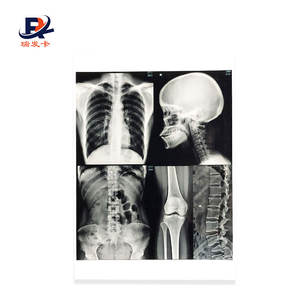 L'imageur Laser sec bleu film médical substitut radiographique <span class=keywords><strong>agfa</strong></span> film pour appareils à rayons x - Product Image 5