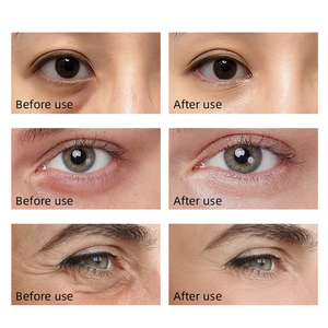 Crème pour les yeux multi-peptides au caviar, hydratante, resserre la zone des yeux, anti-rides, nourrissante pour les cernes, raffermissante, anti-âge - Product Image 5