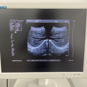 Échographe médical noir et blanc haute performance pour gynécologie, grossesse, usage vétérinaire et humain, avec chariot, modèle BW1100 - Product Image 5