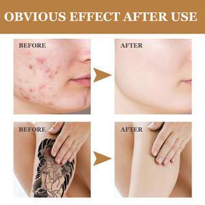 Offre Spéciale Invisible Tatouage Correcteur Crème Couvrir Corps Cicatrice Marque De Naissance Stretch Ecchymose Longue Durée Étanche Tatouage Correcteur - Product Image 2