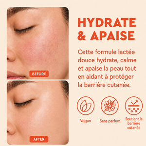 Tonique Visage Lacté Hydratant Apaisant au Cica et Céramide, Végan, Doux pour Peaux Sensibles, Soin Professionnel ODM Marque Blanche - Product Image 2