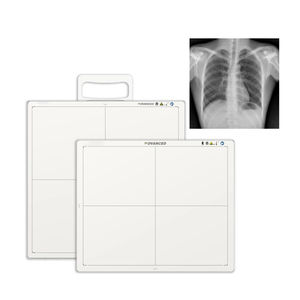 Sıcak satış 17*17 kablosuz DR X Ray düz Panel dedektör - Product Image 1